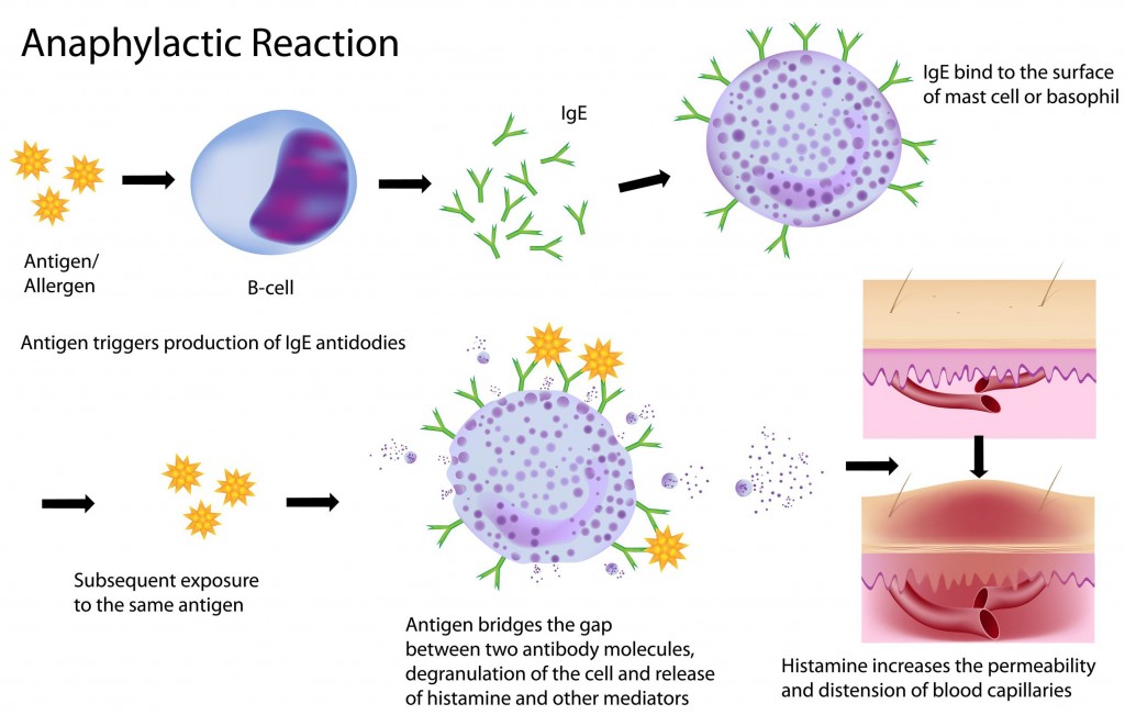 drug allergy - anaphylactic reaction